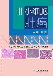 面瘫少爷的落魄女友